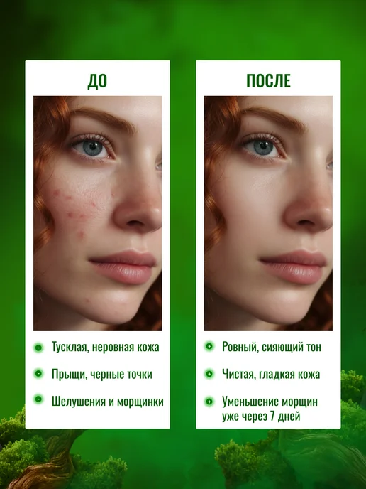 Via Pinky Мыло черное с маслом змеи для кожи 3 в 1 набор 3 шт, 3 шт, фото 6