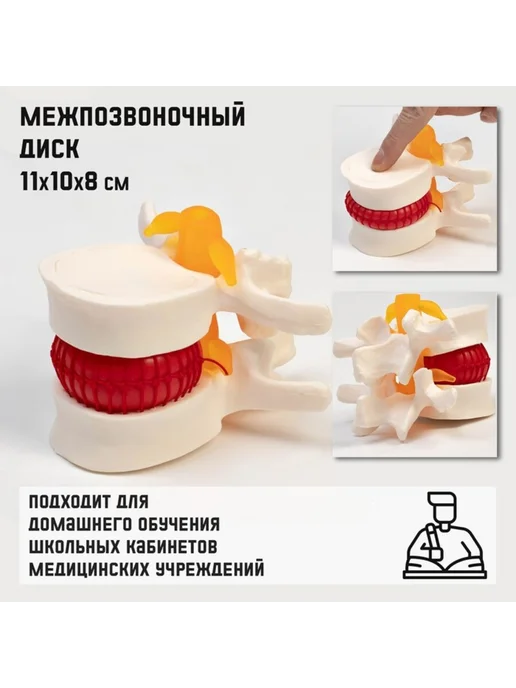 Нимай Нитай Анатомическая модель межпозвонкового диска 11х10х8 см, 10x8 см