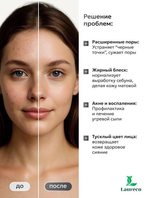 Laureco Угольное мыло от прыщей для лица и тела 1 шт, 1 шт, фото 2