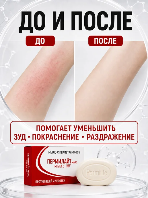 PEROLITE Мыло туалетное Пероалйт с бензоил пероксидом 2,5%, 75 гр, 75 г, фото 5