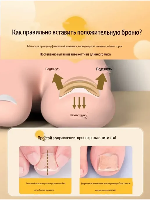 датка7 Корректор вросшего ногтя в домашних условиях 50шт, 50 шт, фото 2