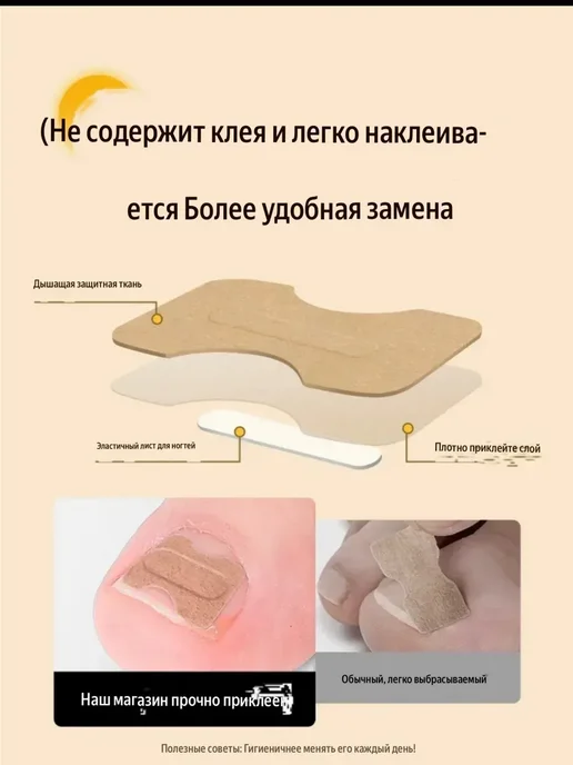 датка7 Корректор вросшего ногтя в домашних условиях 50шт, 50 шт, фото 3